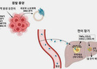 종양 DNA로 암 전이·재발 예방 가능성 확인